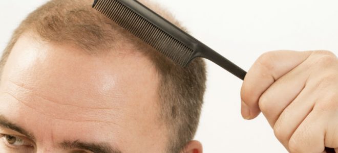 Fast Facts About Follicular Unit Extraction in New York City