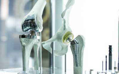 Benefits of a Lightweight Support Brace (KAFO)
