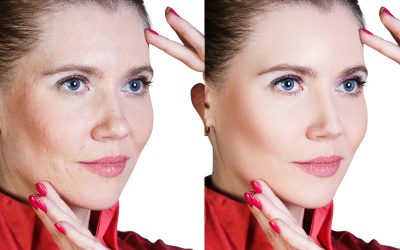 How a Sculptra Face Lift Can Help You Achieve a Youthful, Natural Look – Luxe Beauty & Wellness on Tomball Parkway