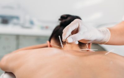 Experience natural relief from chronic pain with acupuncture in Union City, CA.