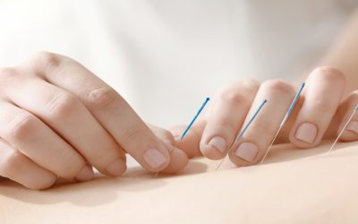 Experience Natural Healing With Acupuncture For Pain in Union City, CA, Chronic Pain Relief