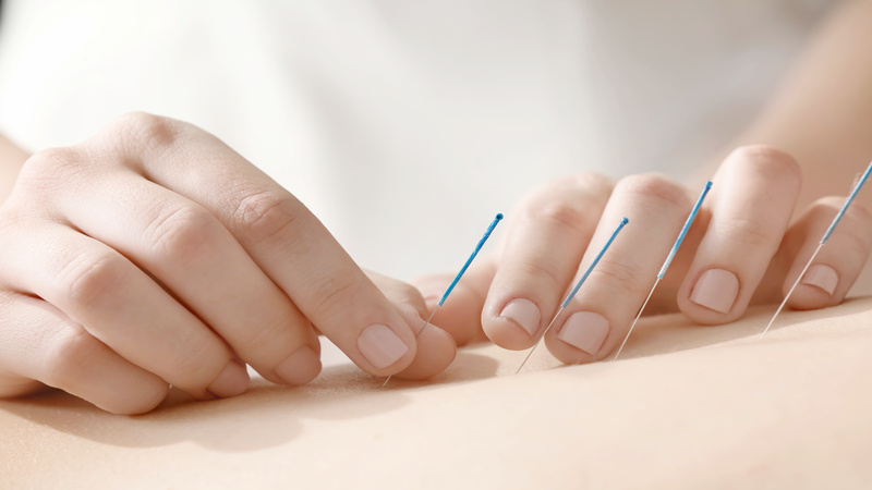 Experience Natural Healing With Acupuncture For Pain in Union City, CA, Chronic Pain Relief