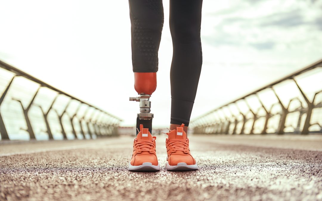 How Prosthetic Care in Meridian, ID Improves Mobility and Quality of Life for Residents
