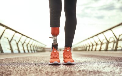 How Prosthetic Care in Meridian, ID Improves Mobility and Quality of Life for Residents