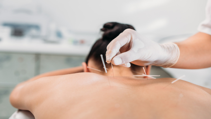 Experience Holistic Healing with a Trusted Local Acupuncturist In Union City, CA Residents Recommend
