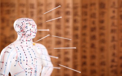 Relieve Anxiety and Feel Balanced With Acupuncture For Stress In Sudden Valley, WA Solutions
