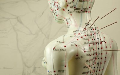 Effective ways acupuncture for pain in Berkeley, CA can help manage chronic discomfort naturally