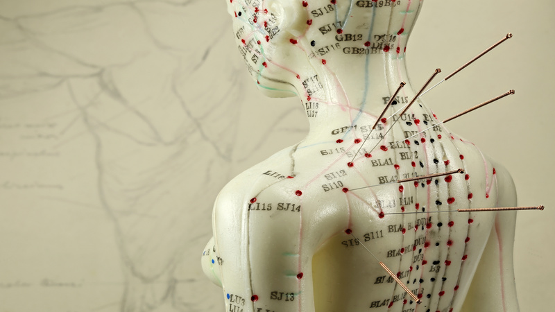 Effective ways acupuncture for pain in Berkeley, CA can help manage chronic discomfort naturally